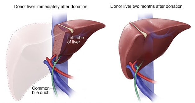 liverregenation